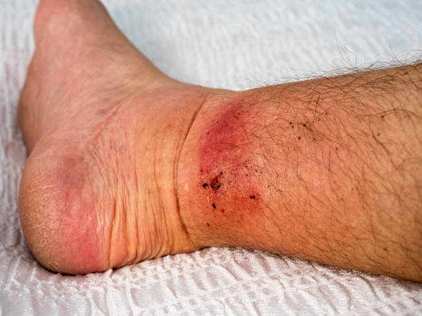 What to Do Immediately After Being Injured at Work in Virginia What to Do Immediately After Being Injured at Work in Virginia